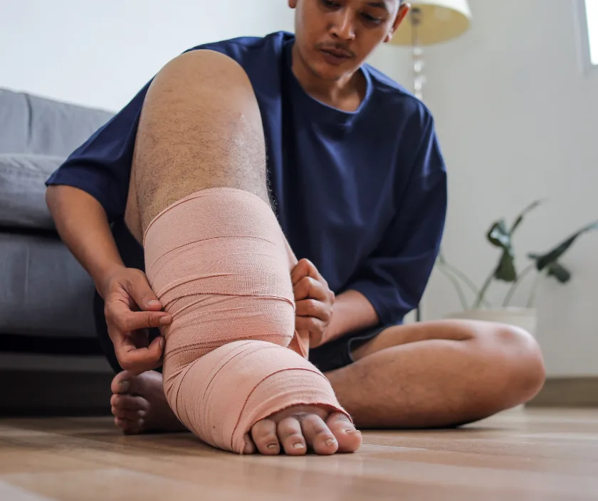 Elephantiasis Treatment, Elegance Clinic Surat