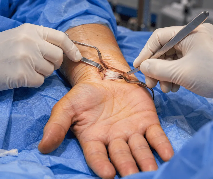 Compression Neuropathies, Elegance Clinic Surat
