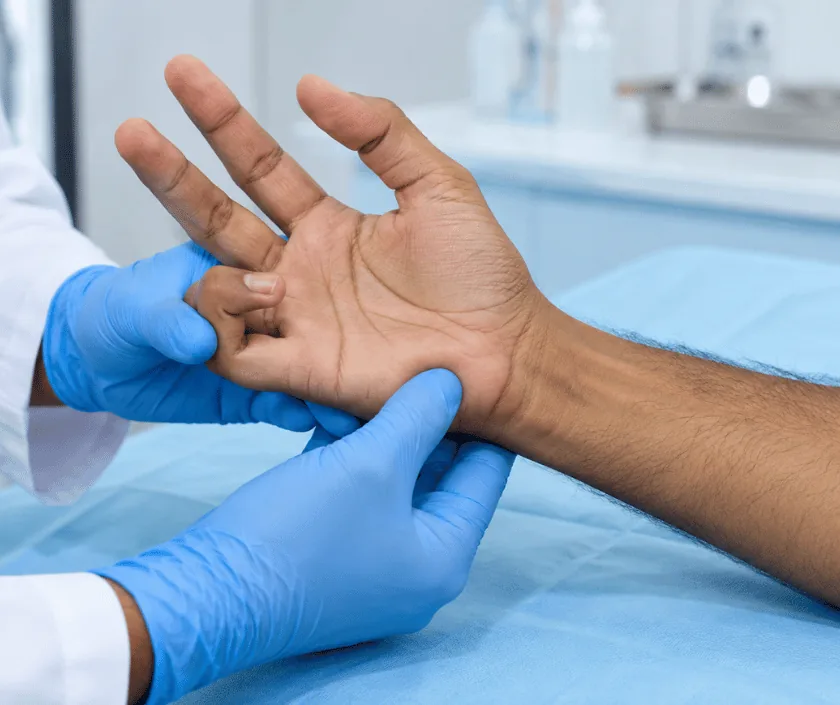 Ulnar Claw Hand Correction, Elegance Clinic Surat