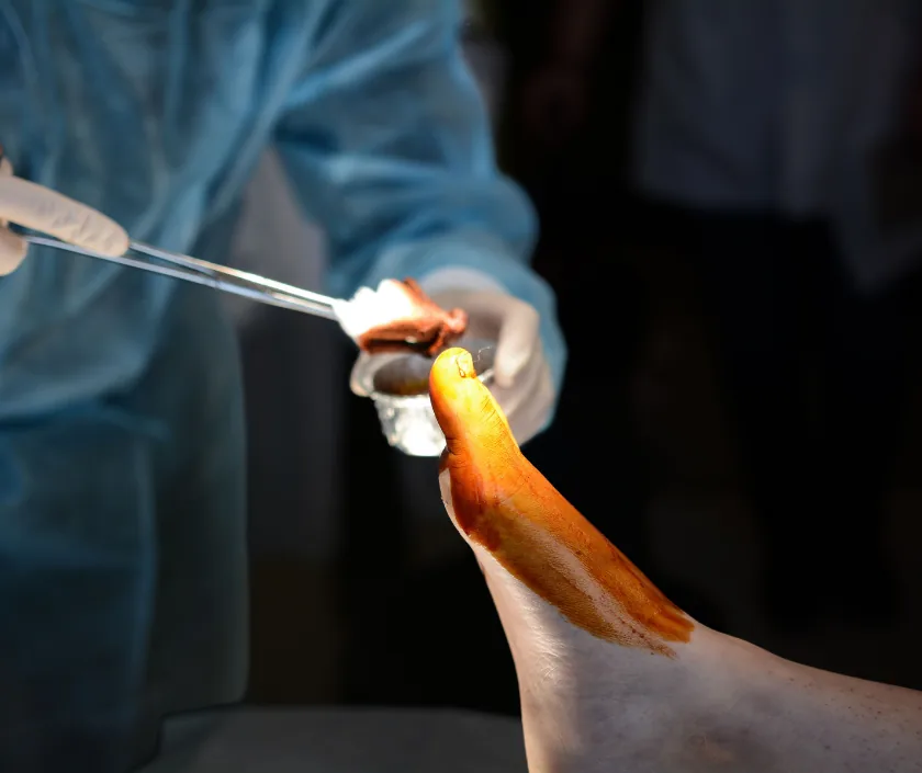 Surgical Treatment, Elegance Clinic Surat